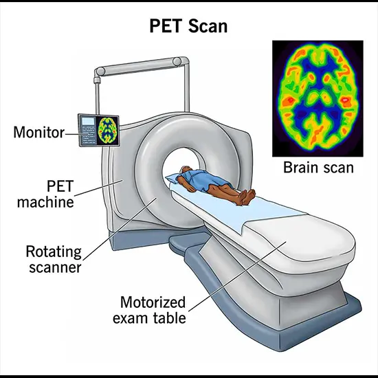 What Is The Role Of PET Scan In Follow up Of Patients?